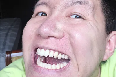 smile