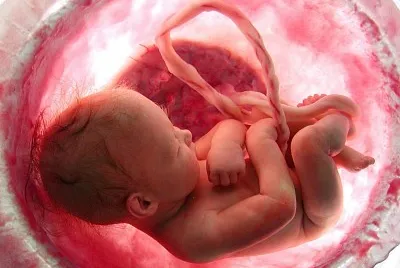 FETO 9 MESES