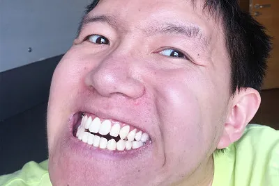 4