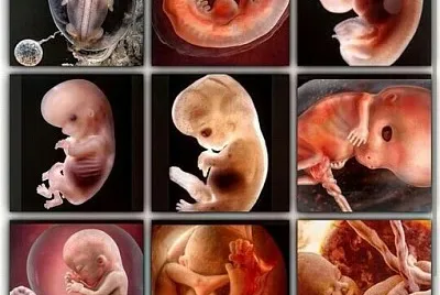 פאזל של Sistema reproductor