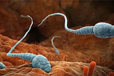 Espermatozoide