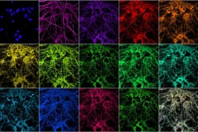multiplexing