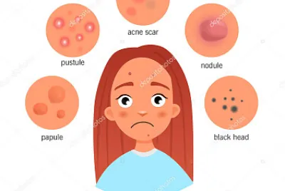 Cambios emocionales