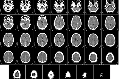 CT of human brain jigsaw puzzle