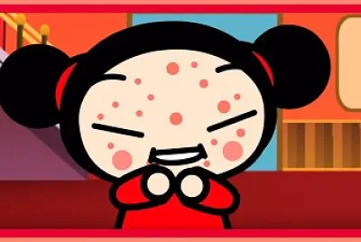 a pucca no le afecta la varicela de gallina pucca