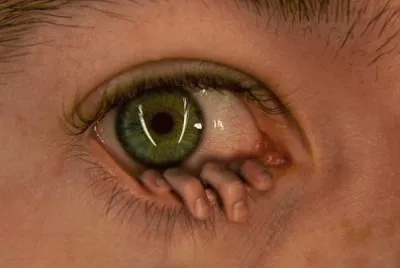 OLHOS