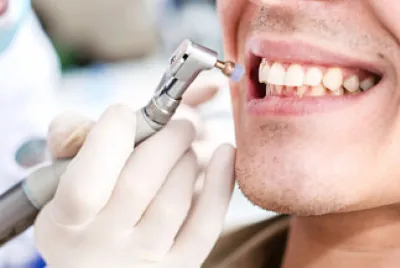 LIMPEZA DENTES