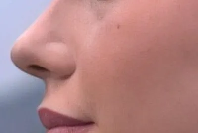 Rosmello/Rosalinda