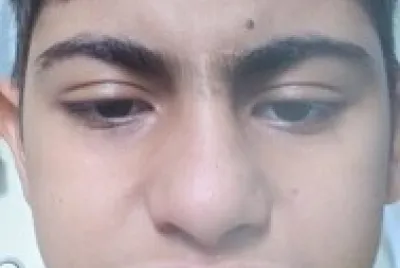Robson face