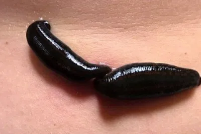 פאזל של SANGUIJUELA