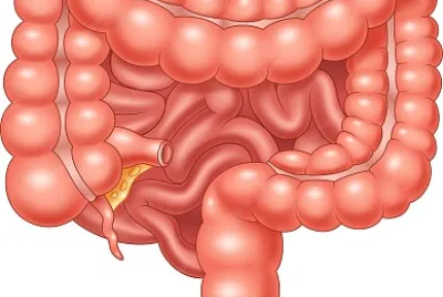 Intestino jigsaw puzzle