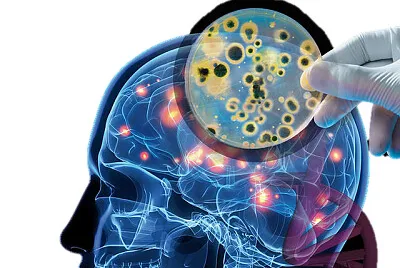 Infecciosas