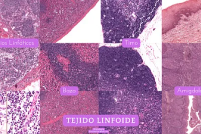 Rompecabezas tejido linfoide histologia