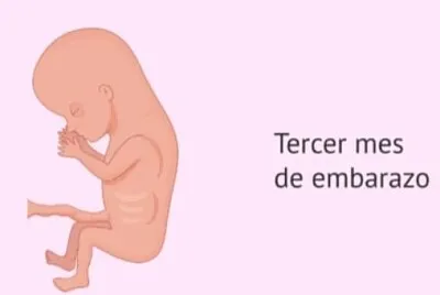 bebe