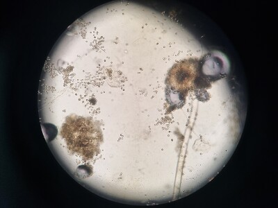 Aspergillus niger