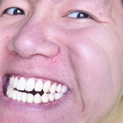 smile