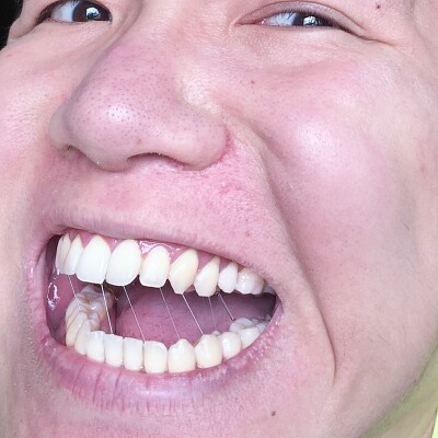 Smile puzzle 3
