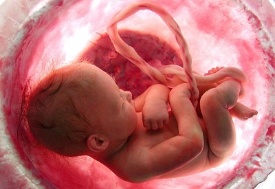FETO 9 MESES