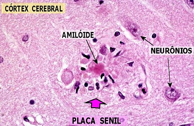 Histo jigsaw puzzle