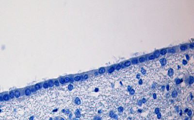 ependyma