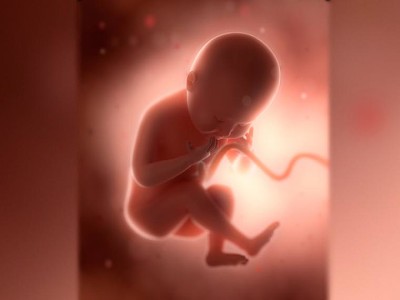aborto