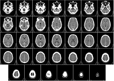 CT of human brain jigsaw puzzle