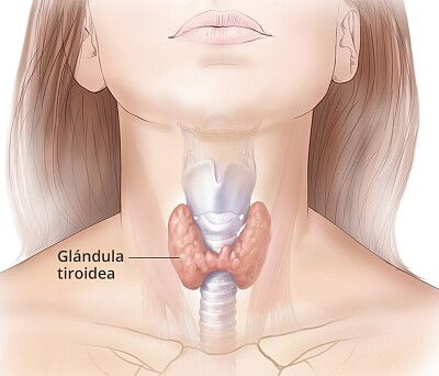 פאזל של Tiroides