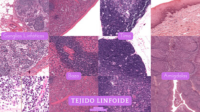 פאזל של Rompecabezas tejido linfoide histologia