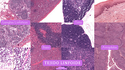 Rompecabezas tejido linfoide histologia jigsaw puzzle